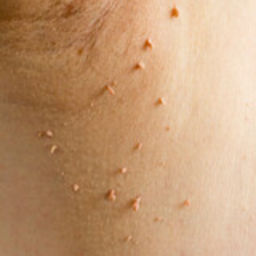 Professional Skin Care